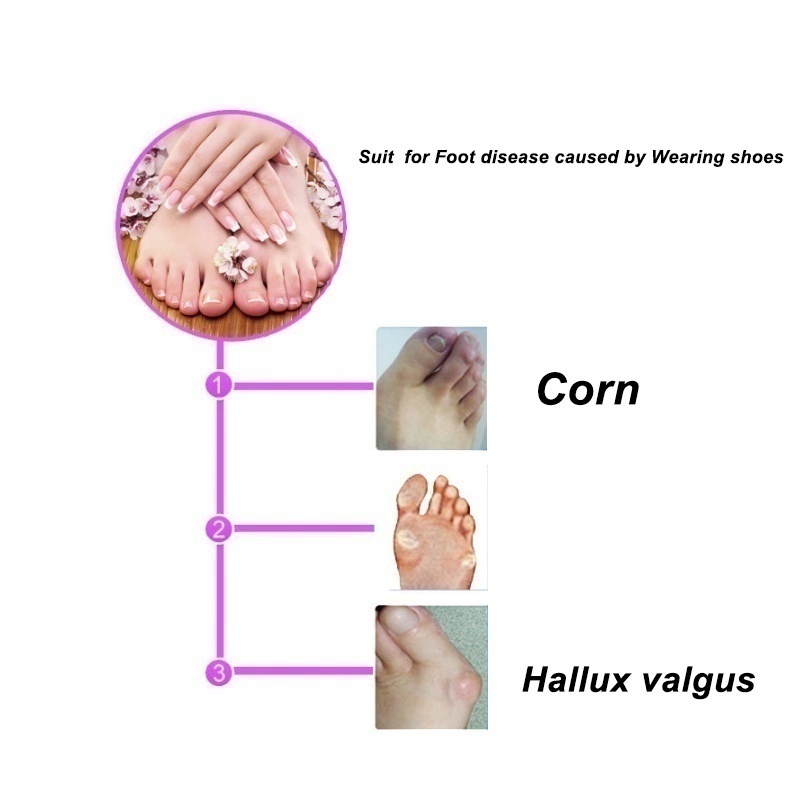 ซิลิโคนแยกนิ้วเท้า Valgus Orthosis อุปกรณ์แยกนิ้วเท้า ราคา ถูกที่สุด ดีลบีเคเค แกลเลอรีภาพที่ 3
