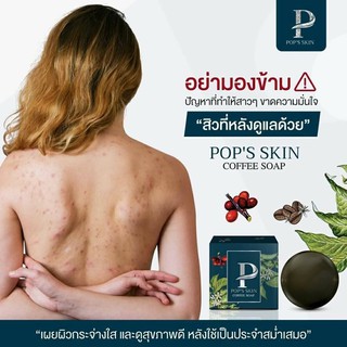 🌿สบู่สมุนไพร🌿ผสมกากกาแฟ☕POPS SKIN COFFEE SOAP