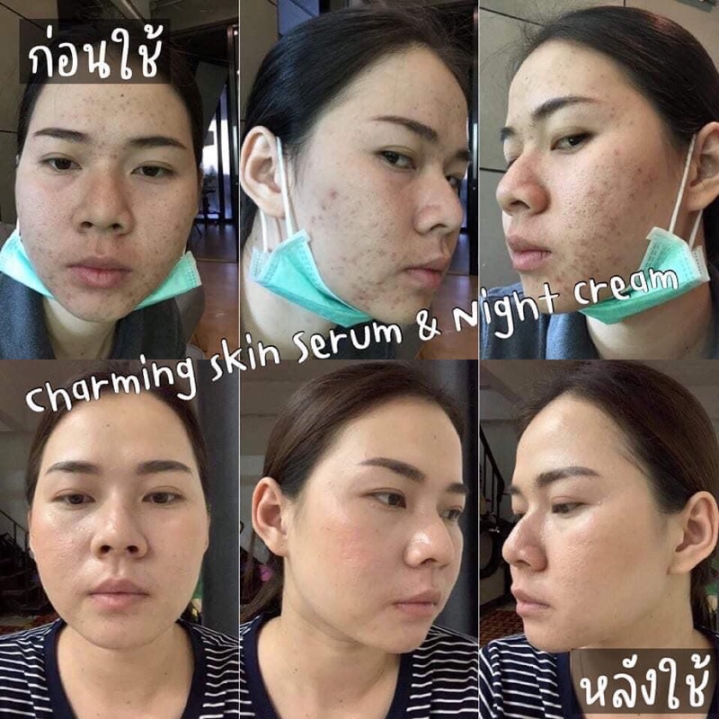ครีมชาร์มมิ่งสกิน [ไนท์ครีม ขนาด 10 กรัม 5กระปุก ครีมบำรุงกระจ่างใสทาก่อนนอน  ราคาส่ง ราคา ถูกที่สุด ดีลบีเคเค แกลเลอรีภาพที่ 6