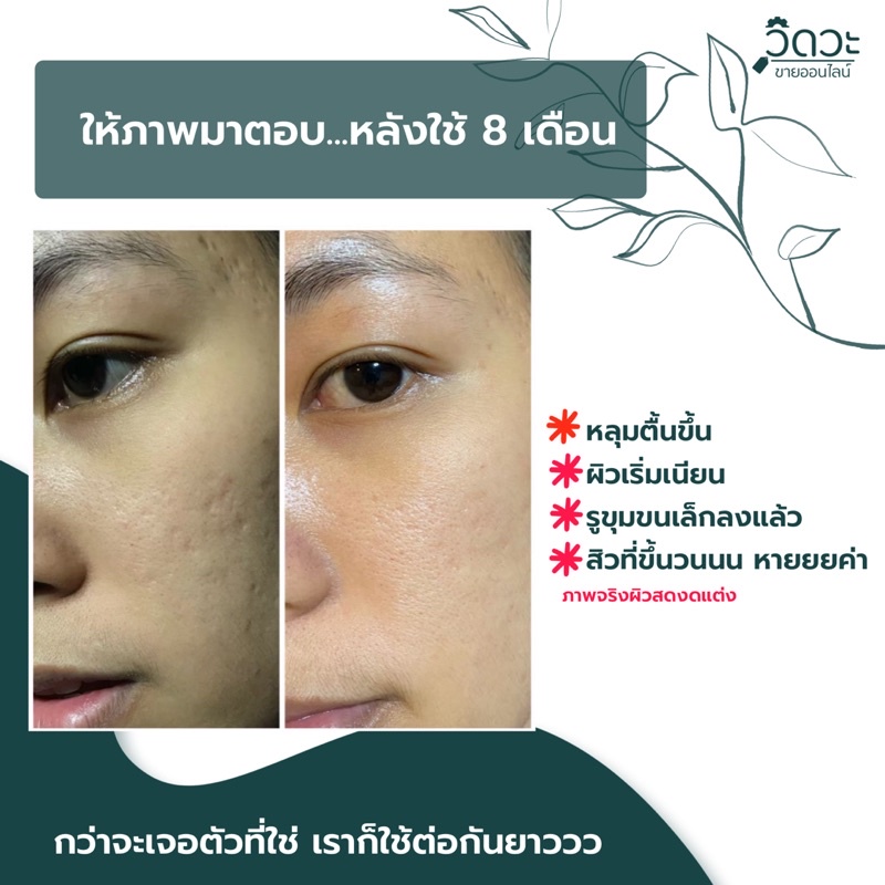 ร้านหมิวค่ะ ส่งด่วน น้ำค้าง [คลีนซิ่งโทนเนอร์-บิวตี้วอเตอร์-Beauty water-DEWellness  )
