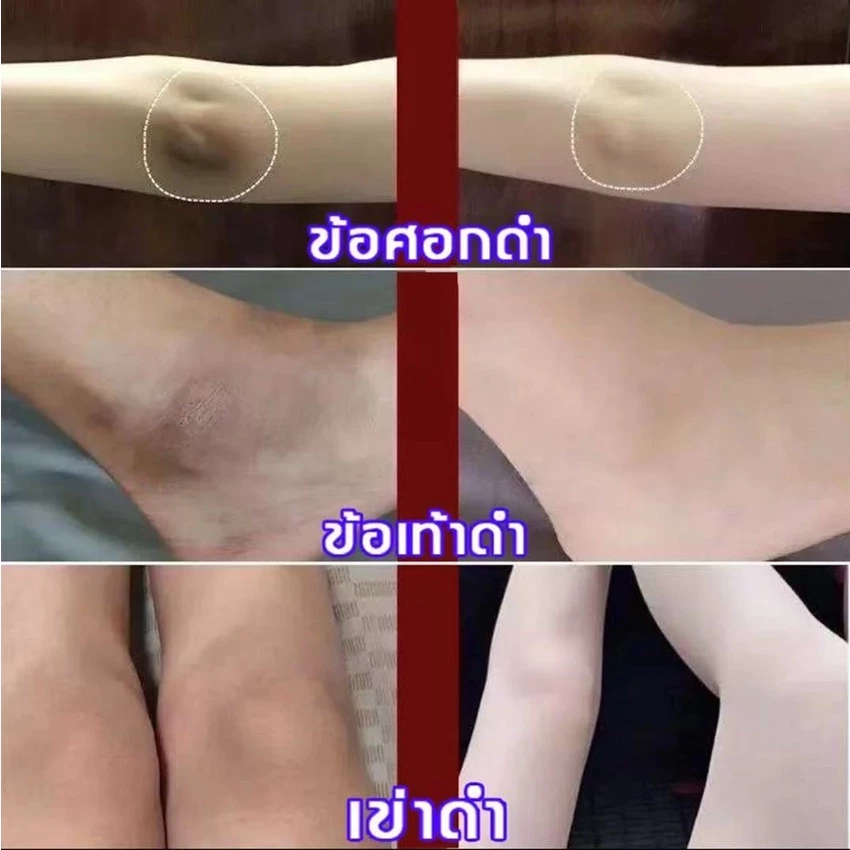 Aichun สบู่สูตรลับ ผิวขาวไว ขัดผิวสมุนไพร บำรุงผิว thumbnail 6
