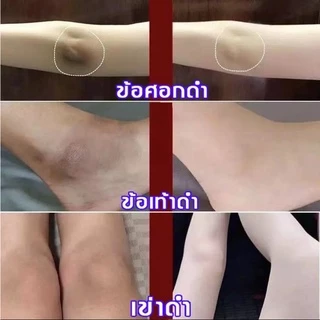 สบู่ผิวขาวถาวร สบู่สูตรลับเฉพาะ สบู่ผิวขาวไว สบู่แองเจิ้ล สบู่ขัดผิวขาว Aichun สบู่ผิวขาว วิ้งไวท์ สบู่ขาว สบู่สูตรเฉพาะ