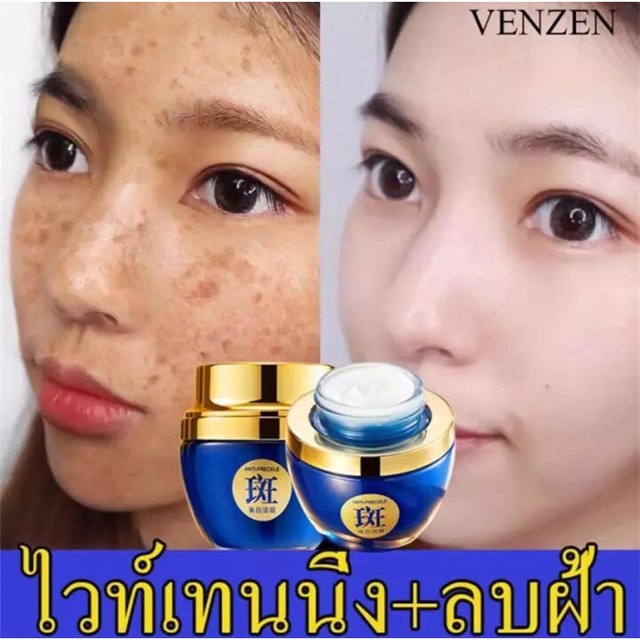 (กำ​จัด​ฝ้า​กระ​ใน​ 7​ วัน​)VENZEN Freckle Cream ครีมทาฝ้ากระ ครีมบำรุงหน้า ครีมหน้าขาวใส ลดฝ้ากระ ค