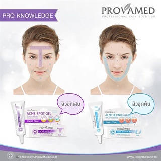 ครีมแต้มสิว-Provamed Acne Retinol-A Gel สิวอุดตัน / Acne Spot Gel สิวอักเสบ