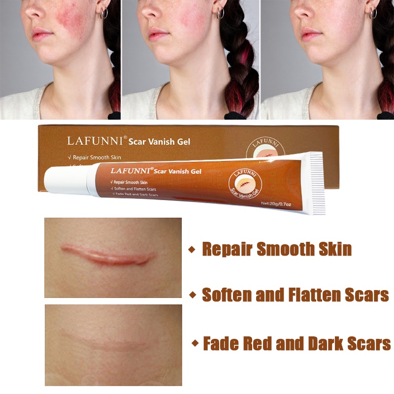 Lafunni เจลลบรอยแผลเป็น สิว รอยแตกลาย เจลลบสิว เรียบเนียน ไวท์เทนนิ่ง ให้ความชุ่มชื้น ดูแลผิวกาย