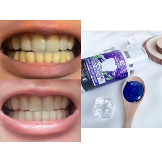 (ซื้อ1แถม1)[ส่งฟรี] ยาสีฟันฟอกฟันขาว Dental Switz #เจลฟอกฟัน