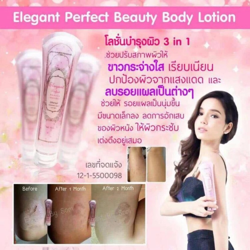 002 อิลิแกนท์ Elegant Perfect Beauty Body Lotion 150 ml โลชั่นผิวขาวกระจ่างใส เรียบเนียน กันแดด ลบรอยแผลเป็น ขาลาย