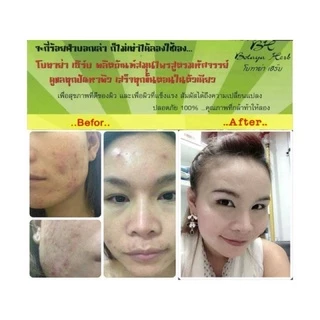 Tinospora Serum เซรั่มบอระเพ็ด เซรั่มโบทาย่า Botaya Herb
