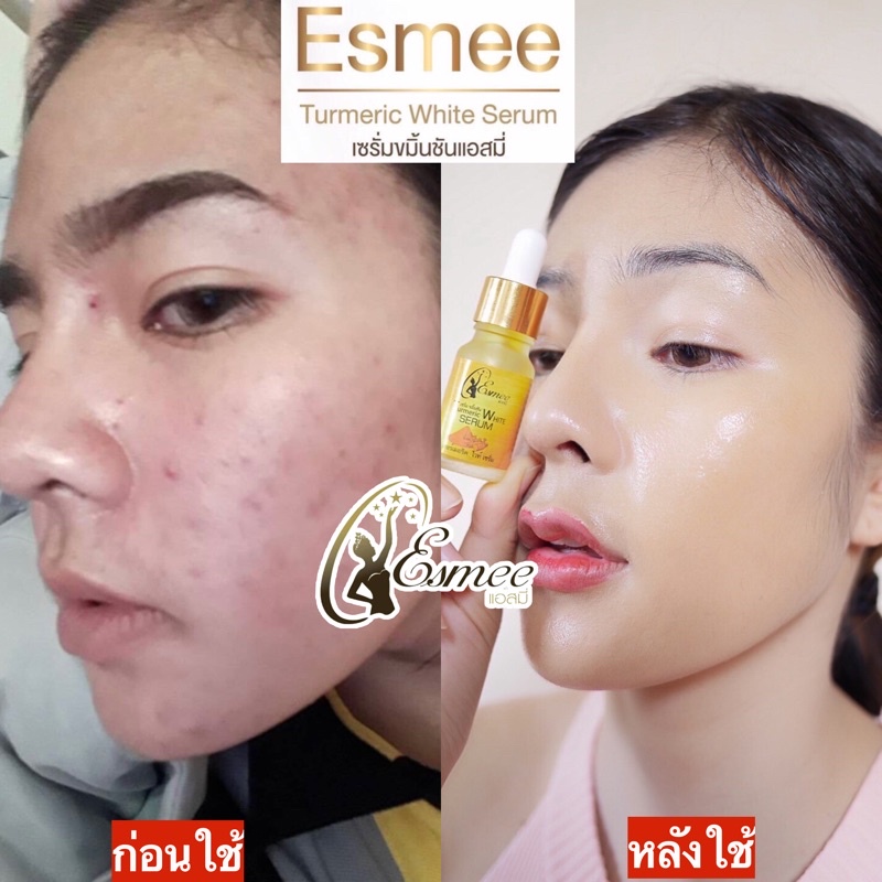 ใส่โค้ด ESME19 ‼️เซรั่มคนท้อง เซรั่มขมิ้นชันแอสมี่ ลดสิว ฝ้ากระ จุดด่างดำ - รูปที่ 2