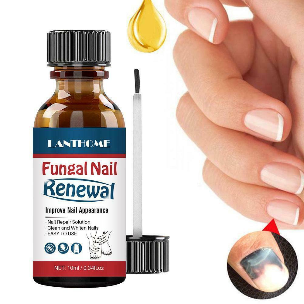 LANTHOME 10ml fungal nail repair nourish fungal nail to anti-infection hand treatment foot G9O6