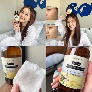 Minaki Pure-ri Premium Cleansing Essence เพียวริ คลีนซิ่ง 400ML ลดสิว ผิวกระจก