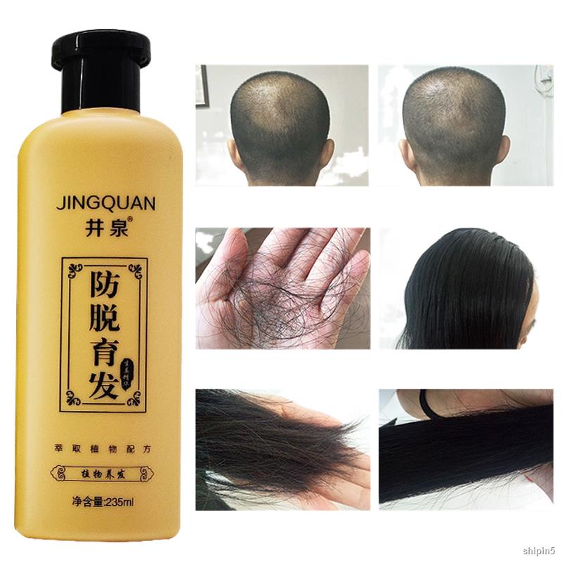 ☍❣✒Shampoo Prevent Hair Loss Nourish Anti-Dandruff Antipruritic Refresh Oil Control Ginger Hair Regrowth Treatment Hair