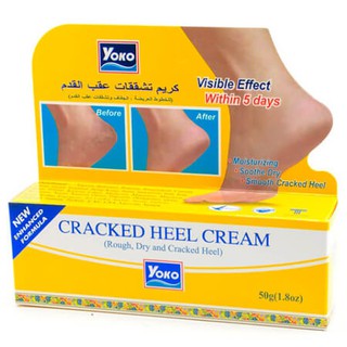 YOKO ครีมทาส้นเท้าแตก สูตรปรับปรุงใหม่ (สีเหลือง) YOKO CRACKED HEEL CREAM (50 g.)