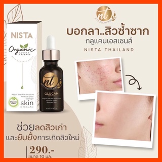 7.25 ส่งฟรี‼️พร้อมส่ง📮 กลูแคนเอสเซนส์ลดสิวผด(ออแกนิก100%) เอสเซนส์ลดสิว ถอนพิษสารสเตียรอยด์ แพ้ง่ายใช้ได้ มีเก็บปลายทาง