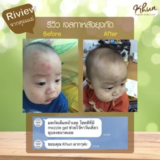เซทคู่สุดคุ้ม ! KHUN คุนเจลทาหลังยุงกัด 18 ml. + สเปร์ยน้ำแร่กันยุง 50 ml.