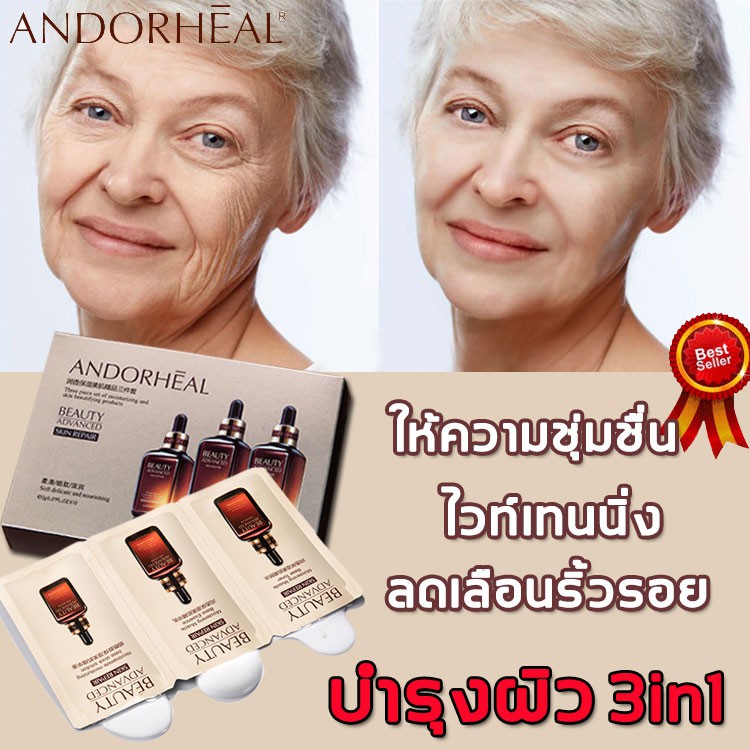 ANDORHEAL  เซรั่มบำรุงผิวหน้า  ครีมหน้าขาว ลดรอยสิวมอยเจอร์ไรเซอร์ ให้ ความชุ่มชื่น  ครีมทาหน้า ครีม