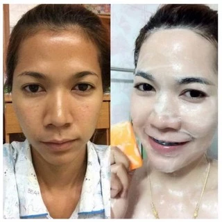 🍊สบู่กลูต้าไวท์ BMK SKINCARE 🍊 ช่วยผลัดเซลล์ผิว เพิ่มความใส✨