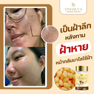 ✅ขายดีอันดับ1แท้💯 จากบริษัทราคานี้เท่านั้น zincolta ซินคอลต้า น้ำมันอาโวคาโดสกัดเย็น คอลลาเจน สิว ฝ้ากระ ผิวแห้ง วัยทอง