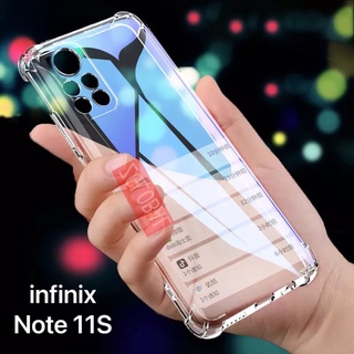 [ เคสใสพร้อมส่ง ] Case infinix Note 11S เคสโทรศัพท์ อินฟินิ๊ก เคสใส เคสกันกระแทก case Infinix note11S