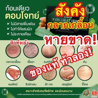 ส่งฟรี‼️ กลากเกลื้อน สิวที่หลัง คอดำ ขาหนีบดำ สบู่ว่านรางจืด สบู่สมุนไพร สะเก็ดเงิน โรคผิวหนัง เชื้อรา อาการคัน