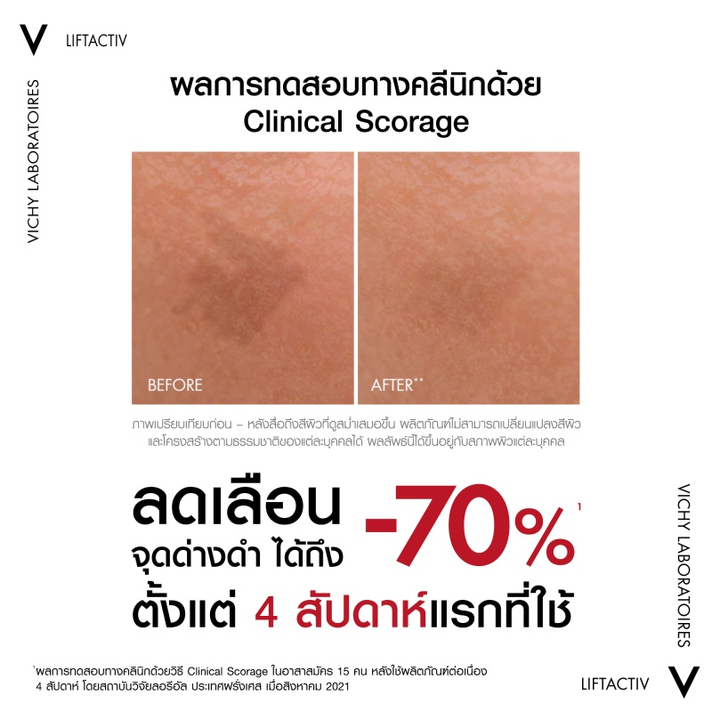 วิชี่ Vichy Liftactiv B3 Serum The Master of Dark Spots Serum เซรั่มตัดวงจรปัญหาจุดด่างดำ 30ml. #8