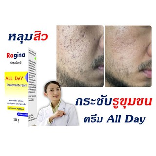 รักษาหลุมสิว กระชับรูขุมขน ครีมเรจิน่า All Day Treatment