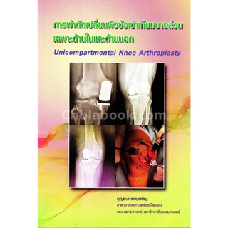 Chulabook(ศูนย์หนังสือจุฬาลงกรณ์มหาวิทยาลัย)C111หนังสือ9786164681903การผ่าตัดเปลี่ยนผิวข้อเข่าเทียมบางส่วนเฉพาะด้านในและด้านนอก (UNICOMPARTMENTAL KNEE ARTHROPLASTY)