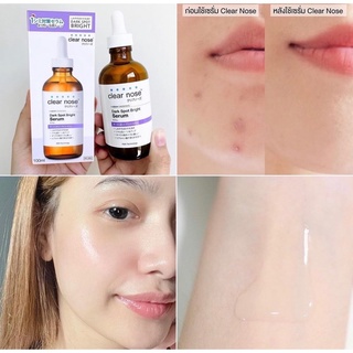 Clear Nose dark spot bright solution serum เซรั่มลดรอยดำจากสิว ปริมาณ100ml.