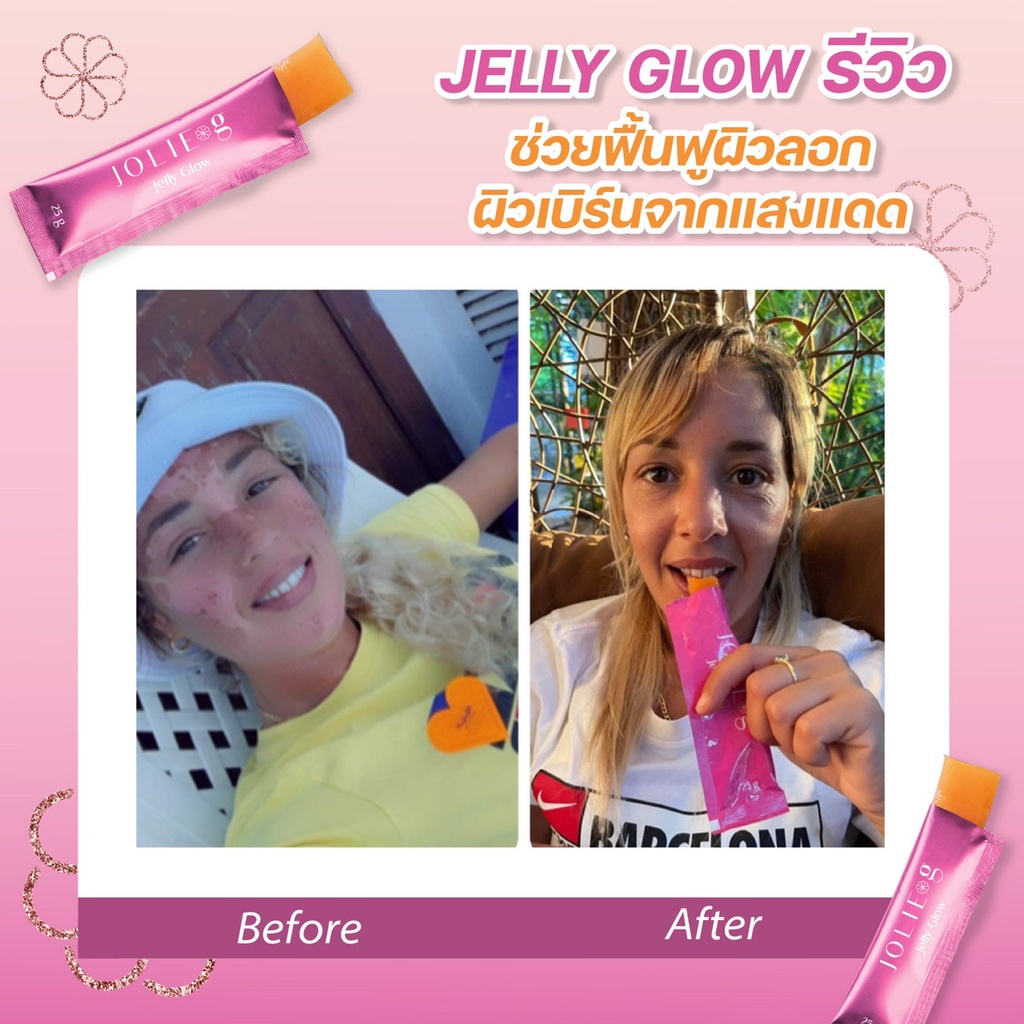 Jolie g. - Jelly glow 50 กล่อง คอลลาเจนหน้าเด็ก แนะนำสำหรับวัย 30 40 ...