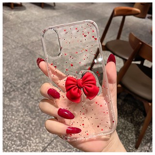 เคส-3D Bow For OPPO Reno 6 A16 A54 A94 A74 A15 A93 Reno 5 Reno 4 A53 A31 A12 A73 A92 A52 F7 A91 A5 2020 Reno 2f F11 pro A7 Reno 2 A3S F9 F7 F5 A5S A9 2020|TYH