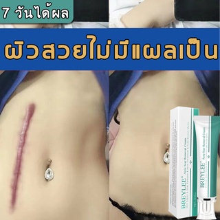 ครีมลบแผลเป็น ครีมทาแผลเป็น breylee รอยแผล ครีมลดแผลเป็น ครีมทาแผลผ่าคลอด Scar cream