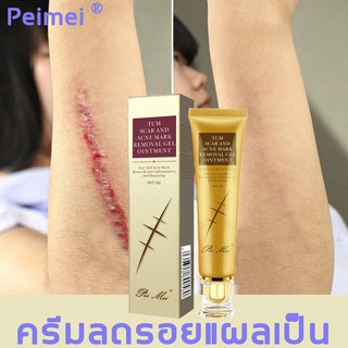 Peimei ครีมทาแผลเป็น ครีมลดรอยสิว รอยแผลเป็น ครีมลดรอยแผลเป็น ครีมลบรอยแผลเป็น เจลลบรอยแผล ครีมซ่อมแซม