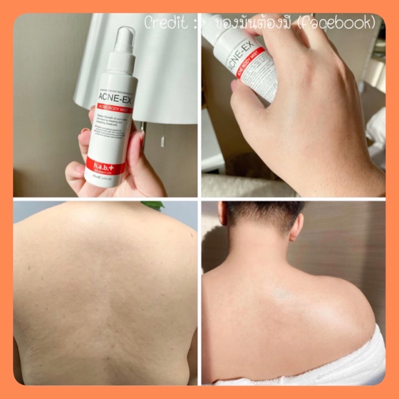 สเปรย์ฉีดสิว ผิวกาย ใช้ดี (กดสินค้าจาก VDO รับโค้ดลดเพิ่ม 30%) (ของเเท้)  Acne ex body spray 120 ml. (WB008) ราคา ถูกที่สุด ดีลบีเคเค