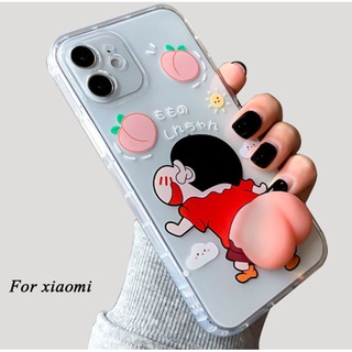 เคสโทรศัพท์มือถือ ลายการ์ตูนชินจังน่ารัก 3D สําหรับ Xiaomi Mi 11 Lite 5G Ne 12 12S ultra Pro 12X 11 11T 10 10T 9 9T 8 Lite Pro 5G