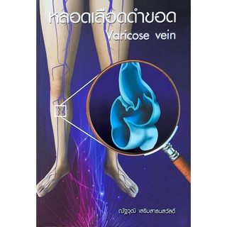 [ศูนย์หนังสือจุฬาฯ] 9786164434028 หลอดเลือดดำขอด (VARICOSE VEIN) (C111)