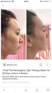 สั่งล่วงหน้า: Neutrogena Light therapy acne spot treatment #7