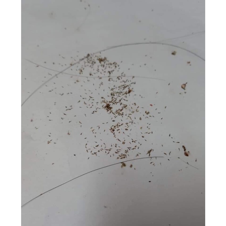 หวีสางเหา หวีสเนียด ซีฟันสแตนเลส 1อัน (คละสี) คุณภาพดี แข็งแรง ทนทาน มีด้ามจับ ตัวเหา ไข่เหาหลุด 100% มีปลายทาง - รูปที่ 5