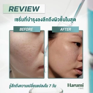 [แท้]HARUMI Hya glow serum 30ml ฮารุมิไฮยาโกลด์เซรั่ม ไฮยาโกเซรั่ม หน้าแห้ง คืนความชุ่มชื้น หน้าอิ่มฟู รูขุมขนกระชับ
