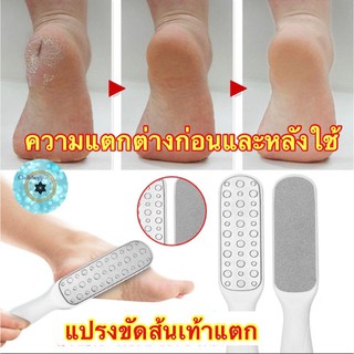 (chsn06)ล , แปรงขัดส้นเท้าแตก , Foot File Pedicure