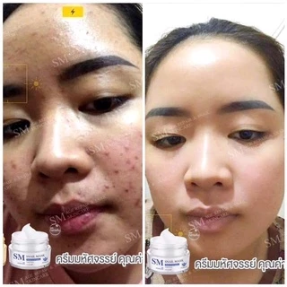 ครีมรกพืชsm ของแท้บริษัท100%[ขายแยก-ยกชุด]10g-15g smskincare