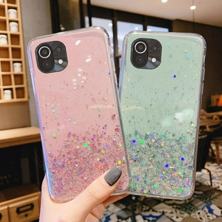 เคสโทรศัพท์มือถือกันกระแทกโปร่งใส สำหรับ Xiaomi Mi 11 Lite 5G NE 11 Pro 11 Ultra 11Lite Mi11Lite นุ่มเคสปก Xiomi Mi11 Lite Phone Case