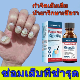 ฆ่าเชื้อราที่เล็บ ❤LANTHOME❤ ยารักษาเชื้อราเล็บ ซรั่มรักษาเล็บ 10ml ยาทาเชื้อราที่เล็บ ซ่อมเล็บที่ชำรุด เชื้อราเล็บ