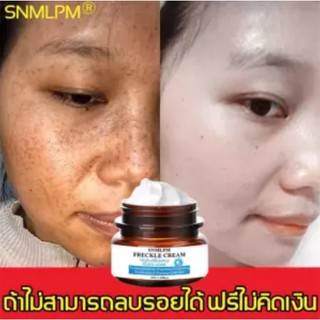 SNMLPM ครีมลดจุดด่างดํา ครีมบำรุงหน้า เซรั่มลดจุดด่างดํา มีประสิทธิภาพลดจุดด่างดำ ฝ้ากระ ยับยั้งการก่อตัวของเมลานิน