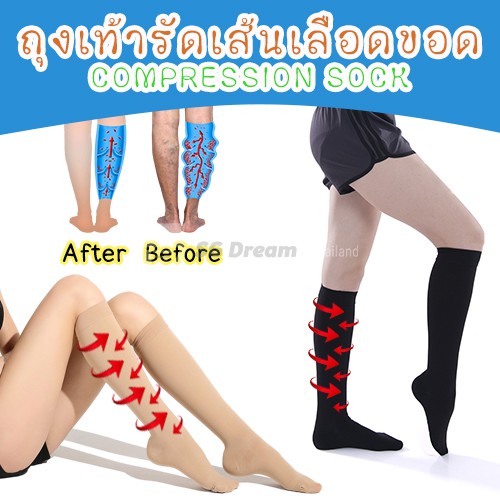 135-ถุงเท้ารัดเส้นเลือดขอด ใส่เพื่อบรรเทาอาการเส้นเลือดขอด