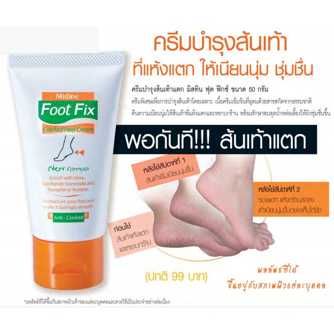 ครีมทาส้นเท้าแตก Mistine Foot Fix Cracked Heel Cream 50g Shopee Thailand