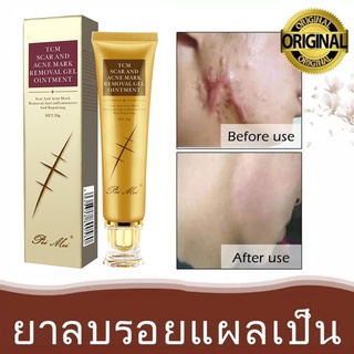 PEIMEI✅30ml ยาลบลอยแผลเป็น คีลอยด์ รอยแดง หลุมสิว ลายท้องหลังคลอด และฟื้นฟูสภาพผิวให้แลดูเรียบเนียนอย่างเป็นธรรมชาติ ครีมลบลอยแผลเป็น รักษาคีลอยด์ ลบรอยแดง ลดหลุมสิว