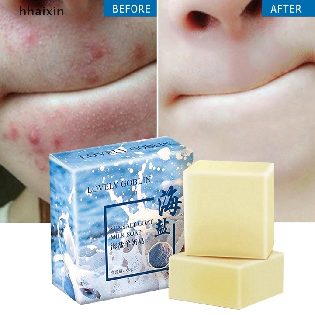 [HaiHai] Sea Salt Soap Removal Pimple Pore Acne Treatment Goat Milk Soap 
 Boutique #5