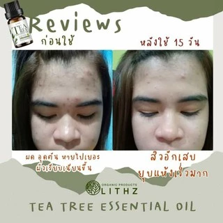 LITHZ TEA TREE ESSENTIAL OIL ไลทซ์ ที ทรี เอสเซนเชียล ออยล์ ทีทรีออยล์ แต้มสิว