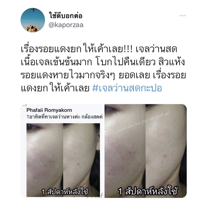 KAPOR เจลว่านหางจระเข้ สูตรลดสิว ลดรอย ฟื้นฟูผิวติดสาร