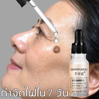 QIANYUGUAN กำจัดไฝ 20ml ไฝไม่ทิ้งร่องรอย ลดไฝลด ไฝดำกำจัดไฝ จี้ขี้แมลงวัน การกำจัดไฝ（กำจัดจุดด่างดำ ครีมทาไฝ）